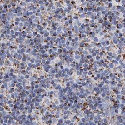 <b>Independent Antibodies Validation. </b>Immunohistochemistry-Paraffin: DECR1 Antibody [NBP1-85264] - Staining of human lymph node.