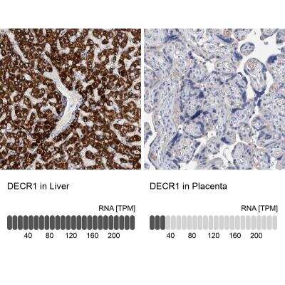 <b>Orthogonal Strategies Validation. </b>Immunohistochemistry-Paraffin: DECR1 Antibody [NBP1-85265] - Staining in human liver and placenta tissues using anti-DECR1 antibody. Corresponding DECR1 RNA-seq data are presented for the same tissues.