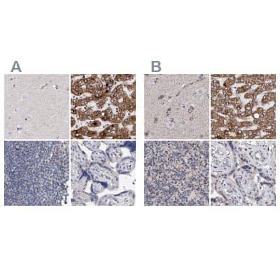 <b>Independent Antibodies Validation. </b>Immunohistochemistry-Paraffin: DECR1 Antibody [NBP1-85265] - Staining of human cerebral cortex, liver, lymph node and placenta using Anti-DECR1 antibody NBP1-85265 (A) shows similar protein distribution across tissues to independent antibody NBP1-85263 (B).