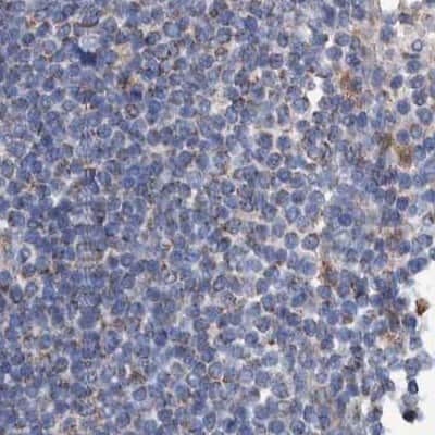 Immunohistochemistry-Paraffin: DECR1 Antibody [NBP1-85265] - Staining of human lymph node.