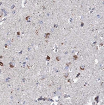 Immunohistochemistry-Paraffin: DECR1 Antibody [NBP1-85265] - Staining of human cerebral cortex shows moderate to strong granular cytoplasmic positivity in neurons.