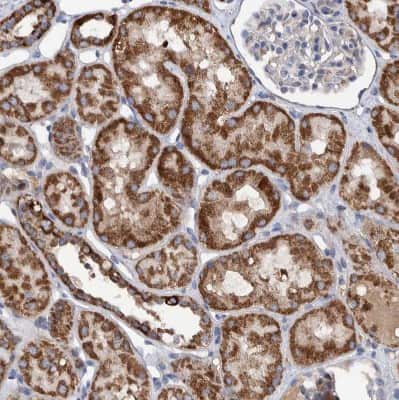 Immunohistochemistry-Paraffin: DECR1 Antibody [NBP1-85265] - Staining of human kidney shows moderate to strong granular cytoplasmic positivity in cells in tubules.
