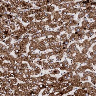 Immunohistochemistry-Paraffin: DECR1 Antibody [NBP1-85265] - Staining of human liver shows moderate to strong granular cytoplasmic positivity in hepatocytes.