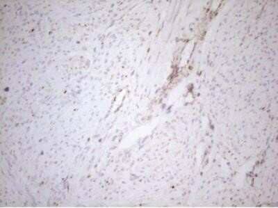 Immunohistochemistry: DECR1 Antibody (OTI4G4) - Azide and BSA Free [NBP2-70564] - Staining of paraffin-embedded Human endometrium tissue within the normal limits using anti-DECR1 mouse monoclonal antibody. (Heat induced epitope retrieval by 1mM EDTA in 10mM Tris buffer (pH8.5) at 120 degrees C for 3 min, 1:150)