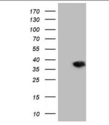 Western Blot: DECR1 Antibody (OTI4G4) - Azide and BSA Free [NBP2-70564] - HEK293T cells were transfected with the pCMV6-ENTRY control (Left lane) or pCMV6-ENTRY DECR1 ( Right lane) cDNA for 48 hrs and lysed. Equivalent amounts of cell lysates (5 ug per lane) were separated by SDS-PAGE and immunoblotted with antiDECR1.(1:2000)