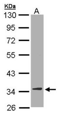 Western Blot: DECR1 Antibody [NBP1-33103] - Sample (30 ug of whole cell lysate) A: Hep G2 10% SDS PAGE; antibody diluted at 1:10000.