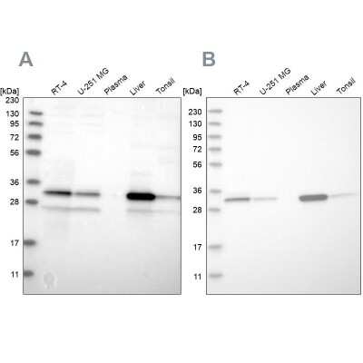 Western Blot DECR1 Antibody - BSA Free