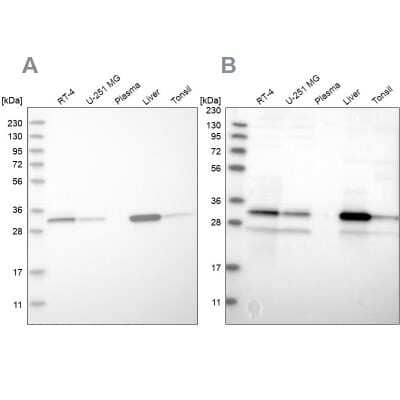 Western Blot: DECR1 Antibody [NBP1-85264] - Analysis using Anti-DECR1 antibody NBP1-85264 (A) shows similar pattern to independent antibody NBP1-85263 (B).