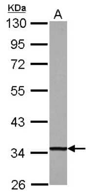 Western Blot: DECR1 Antibody [NBP2-16144] - Sample (30 ug of whole cell lysate) A: HepG2 10% SDS PAGE gel, diluted at 1:10000.