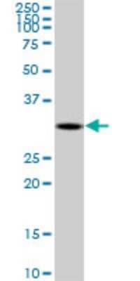 Western Blot: DECR2 Antibody (4A7) [H00026063-M03] - Analysis of DECR2 expression in Jurkat (Cat # L017V1).