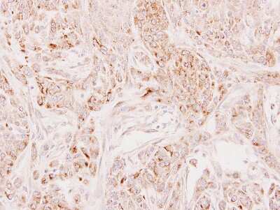 Immunohistochemistry-Paraffin: DECR2 Antibody [NBP2-16145] - Immunohistochemical analysis of paraffin-embedded A549 xenograft, using antibody at 1:100 dilution.
