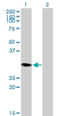 Western Blot: DECR2 Antibody [H00026063-B01P] - Analysis of DECR2 expression in transfected 293T cell line by DECR2 polyclonal antibody.  Lane 1: DECR2 transfected lysate(32.12 KDa). Lane 2: Non-transfected lysate.