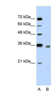 Western Blot: DECR2 Antibody [NBP1-53172] - Jurkat cell lysate, concentration 5.0ug/ml.