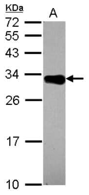 Western Blot: DECR2 Antibody [NBP2-16145] - Sample (30 ug of whole cell lysate) A: A549 12% SDS PAGE gel, diluted at 1:1000.