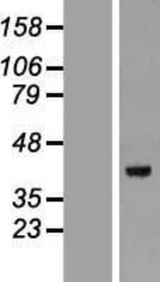 Western Blot: DEDD Overexpression Lysate (Adult Normal) [NBP2-08530] Left-Empty vector transfected control cell lysate (HEK293 cell lysate); Right -Over-expression Lysate for DEDD.
