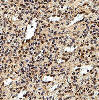 Immunohistochemistry-Paraffin: DEDD2 Antibody [NB100-56138] - DEDD2 was detected in immersion fixed paraffin-embedded sections of human spleen using Rabbit Anti-Human DEDD2 polyclonal Antibody (Catalog # NB100-56138) at 1:500 for 1 hour at room temperature followed by incubation with the Anti-Rabbit IgG VisUCyte™ HRP Polymer Antibody (Catalog # VC003). Tissue was stained using DAB (brown) and counterstained with hematoxylin (blue). Specific staining was localized to the cytoplasm and plasma membrane in splenocytes