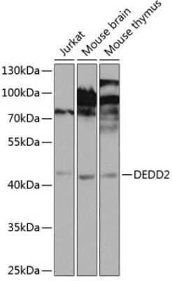 Western Blot: DEDD2 Antibody [NBP3-04558] - Analysis of extracts of various cell lines, using DEDD2 antibody at 1:1000 dilution. Secondary antibody: HRP Goat Anti-Rabbit IgG (H+L) at 1:10000 dilution. Lysates/proteins: 25ug per lane. Blocking buffer: 3% nonfat dry milk in TBST. Detection: ECL Enhanced Kit