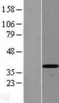 Western Blot: DEDD2 Overexpression Lysate (Adult Normal) [NBL1-09816] Left-Empty vector transfected control cell lysate (HEK293 cell lysate); Right -Over-expression Lysate for DEDD2.