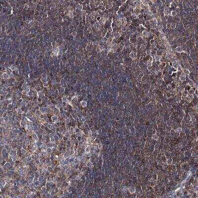 Immunohistochemistry-Paraffin: DEF6 Antibody [NBP1-81617] - Staining of human lymph node shows moderate cytoplasmic positivity.