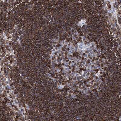 Immunohistochemistry-Paraffin: DEF6 Antibody [NBP1-81618] - Staining of human lymph node shows high expression.