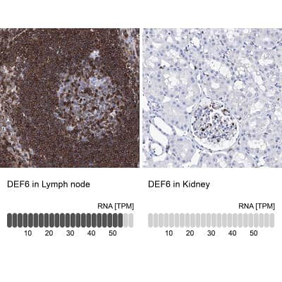 <b>Orthogonal Strategies Validation. </b>Immunohistochemistry-Paraffin: DEF6 Antibody [NBP1-81618] - Staining in human lymph node and kidney tissues using anti-DEF6 antibody. Corresponding DEF6 RNA-seq data are presented for the same tissues.