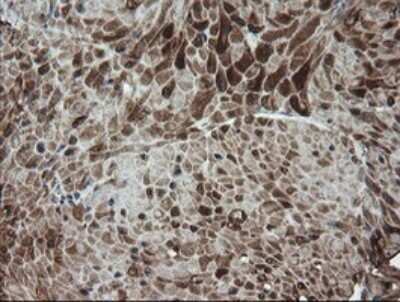 Immunohistochemistry: DEF6 Antibody (OTI3F9) - Azide and BSA Free [NBP2-71868] - Analysis of Human bladder tissue.