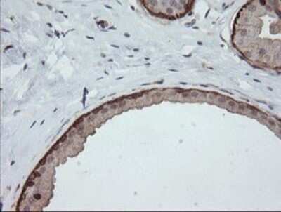 Immunohistochemistry: DEF6 Antibody (OTI3F9) - Azide and BSA Free [NBP2-71868] - Analysis of Human breast tissue.