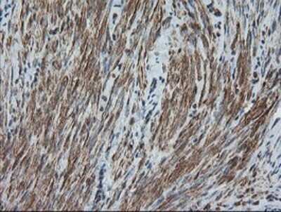 Immunohistochemistry: DEF6 Antibody (OTI3F9) - Azide and BSA Free [NBP2-71868] - Analysis of Human endometrium tissue.