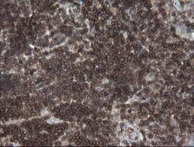 Immunohistochemistry: DEF6 Antibody (OTI3F9) - Azide and BSA Free [NBP2-71868] - Analysis of Human tonsil tissue.