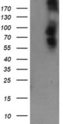 Western Blot: DEF6 Antibody (OTI3F9) - Azide and BSA Free [NBP2-71868] - Analysis of HEK293T cells were transfected with the pCMV6-ENTRY control (Left lane) or pCMV6-ENTRY DEF6.