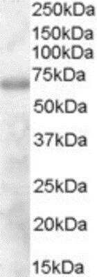 Western Blot: DEF6 Antibody [NB300-837] - Analysis of DEF6 on Human Thymus lysate using NB300-837 at 1ug/ml (35ug protein in RIPA buffer). Primary incubation was 1 hour. Detected by chemiluminescence.