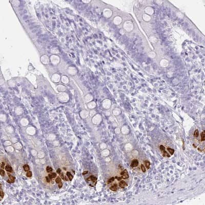 Immunohistochemistry-Paraffin: DEFA6 Antibody [NBP1-84281] - Staining of human duodenum shows cytoplasmic positivity in Paneth cells.