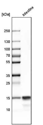<b>Orthogonal Strategies Validation. </b>Western Blot: DEFA6 Antibody [NBP1-84281] - Analysis in human small intestine tissue.