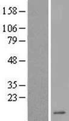 Western Blot DEFA6 Overexpression Lysate