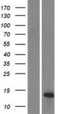 Western Blot: DEFB108B Overexpression Lysate (Adult Normal) [NBP2-08947] Left-Empty vector transfected control cell lysate (HEK293 cell lysate); Right -Over-expression Lysate for DEFB108B.
