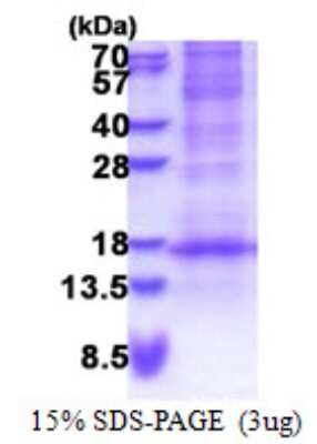 SDS-Page: DEFB116 Protein [NBP2-22992]