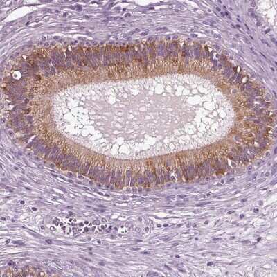 Immunohistochemistry-Paraffin: DEFB118 Antibody [NBP1-90695] - Staining of human epididymis shows high expression.
