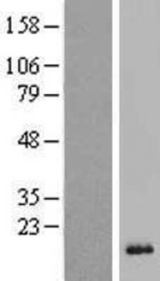Western Blot: DEFB118 Overexpression Lysate (Adult Normal) [NBP2-05810] Left-Empty vector transfected control cell lysate (HEK293 cell lysate); Right -Over-expression Lysate for DEFB118.