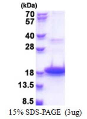 SDS-Page: Recombinant Human DEFB118 Protein [NBP2-22993]
