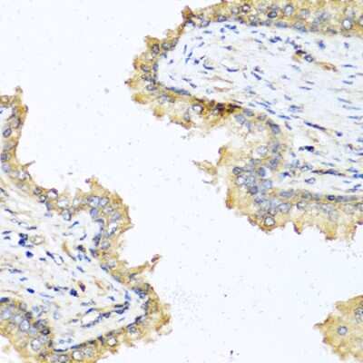 Immunohistochemistry-Paraffin: DEFB121 Antibody [NBP3-04788] - Paraffin-embedded human prostate using DEFB121 antibody at dilution of 1:100 (40x lens).