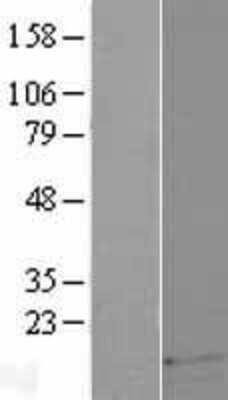 Western Blot: DEFB121 Overexpression Lysate (Adult Normal) [NBP2-08788] Left-Empty vector transfected control cell lysate (HEK293 cell lysate); Right -Over-expression Lysate for DEFB121.