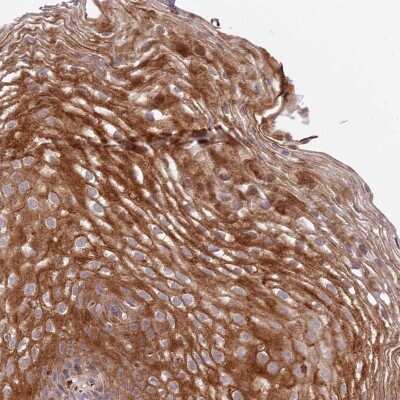 Immunohistochemistry-Paraffin: DEFB125 Antibody [NBP1-90595] - Staining of human esophagus shows moderate cytoplasmic positivity in squamous epithelial cells.