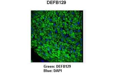 Immunohistochemistry: DEFB129 Antibody [NBP2-82832] - Sample Type: Pig bronchus smooth muscle cells . Primary Antibody Dilution: 1:100. Secondary Antibody: Goat anti-rabbit-FITC. Secondary Antibody Dilution: 1:100. Color/Signal Descriptions: Green: DEFB129. Blue: DAPI. Gene Name: DEFB129. Submitted by: Anonymous