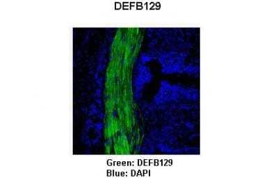 Immunohistochemistry: DEFB129 Antibody [NBP2-82832] - Researcher: Anonymous. Application: IHC. Species + Tissue/Cell type: Pig bronchus smooth muscle cells. Primary antibody dilution: 1:100. Secondary antibody: Goat anti-rabbit-FITC. Secondary antibody dilution: 1:100