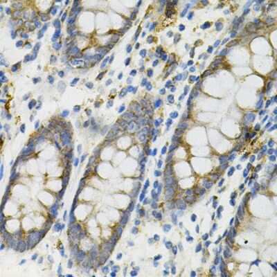 Immunohistochemistry-Paraffin DEFB132 Antibody - BSA Free