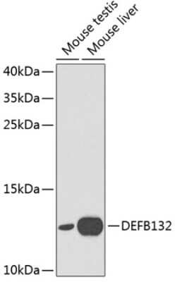 Western Blot: DEFB132 Antibody [NBP2-92037] - Analysis of extracts of various cell lines, using DEFB132 at 1:1000 dilution.Secondary antibody: HRP Goat Anti-Rabbit IgG (H+L) at 1:10000 dilution.Lysates/proteins: 25ug per lane.Blocking buffer: 3% nonfat dry milk in TBST.