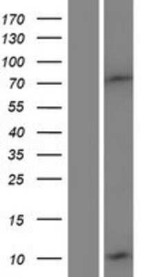 Western Blot: DEFB132 Overexpression Lysate (Adult Normal) [NBP2-04504] Left-Empty vector transfected control cell lysate (HEK293 cell lysate); Right -Over-expression Lysate for DEFB132.