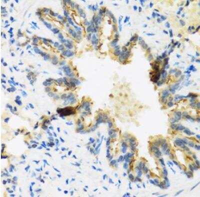 Immunohistochemistry-Paraffin DEFB4B Antibody - BSA Free