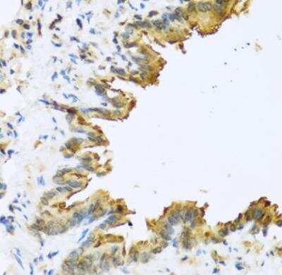 Immunohistochemistry-Paraffin DEFB4B Antibody - BSA Free