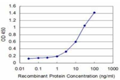 ELISA: DEGS1 Antibody (2E9) [H00008560-M04] - Detection limit for recombinant GST tagged DEGS1 is approximately 0.3ng/ml as a capture antibody.